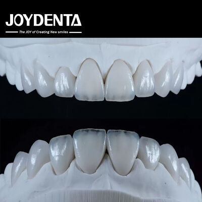Naturale Emax Veneer di porcellana comodo Fit Ultra sottile Emax Veneer