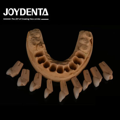Finitura dentale feldspatica ad adattamento preciso altamente naturale con una consistenza superficiale lucida