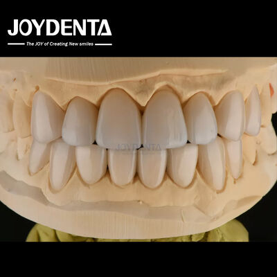 0.3-0.5mm di spessore Feldspathic Porcellana Veneer Alta resistenza alle fratture Aggiornare il tuo sorriso