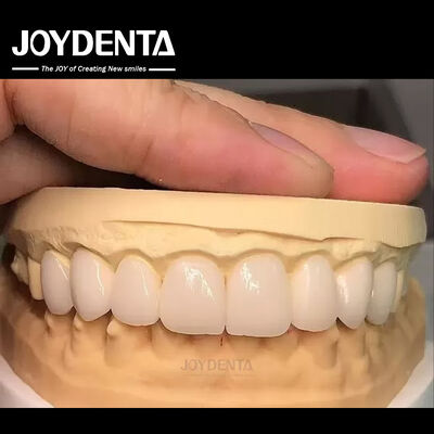 16 sfumature Colore Emax Finiture dentali A1-A4 Alta resistenza alle macchie Per un sorriso perfetto