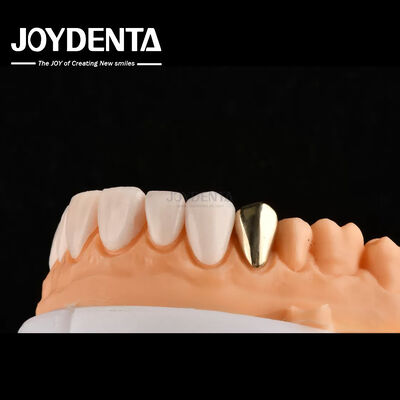 IPS ultra sottile Emax Pressa Veneers Veneers cosmetici dentali per restauri anteriori posteriori