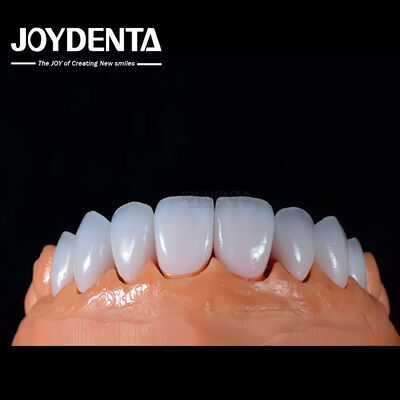 A1-A4 Ips Emax Press Porcellana Finiture dentali resistenti alle macchie Forma personalizzabile