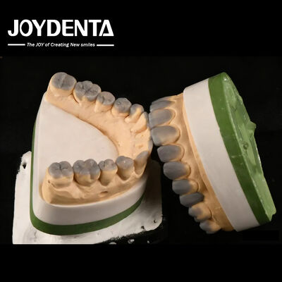 Accuratezza elevata di cera dentale temporanea per la diagnosi personalizzata spessore 1-2 mm