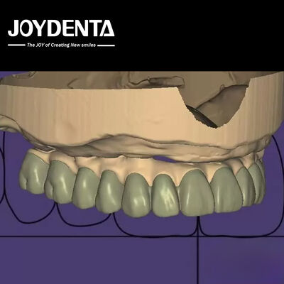 Progettazione personalizzata di laboratorio di diagnostica digitale Wax Up Software integrazione senza soluzione di continuità