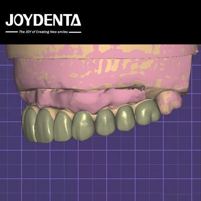 Sicurezza dei dati conforme all'HIPAA Modello 3D di ceretta digitale per le modifiche dentali
